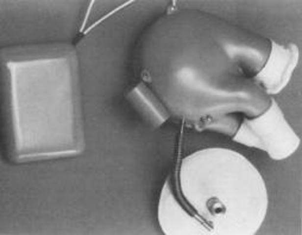 First artificial heart