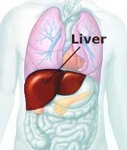Artificial liver