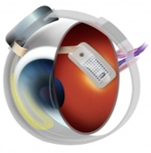 Robótica a la medicina