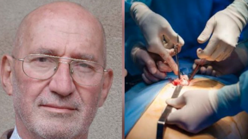 Primera colecistectomia laparoscopica