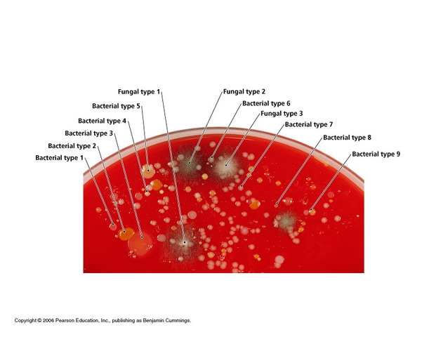 Louis Pasteur and Robert Koch establish the germ theory of disease