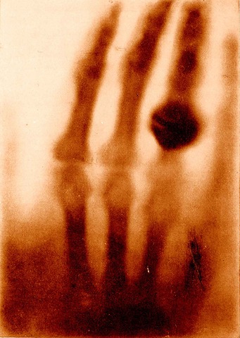 Wilhelm Conrad Roentgen discovers X-rays