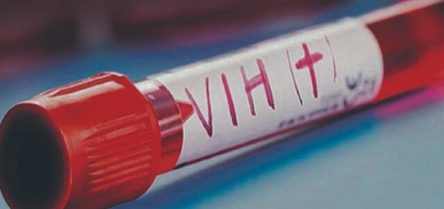 VIH o SIDA