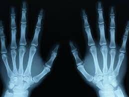 Se descubren los rayos X y se estudian sus propiedades.