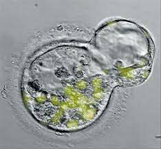 Se clona el gen de la insulina humana.