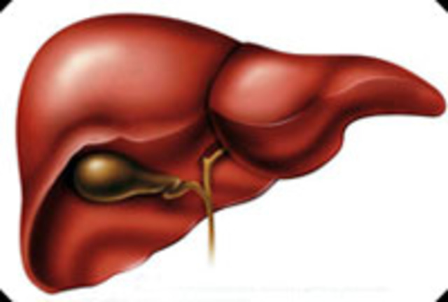 Artificial liver
