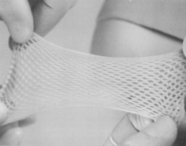 Synthetic skin by G. Gregory Gallico, III