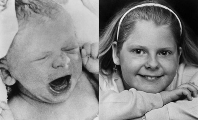 1978. Louise Brown, la primera bebé probeta