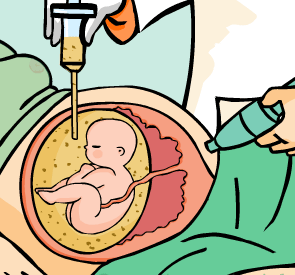 Enfermedad humana por medio del análisis del ADN