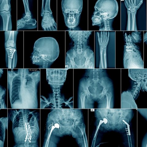 X-rays