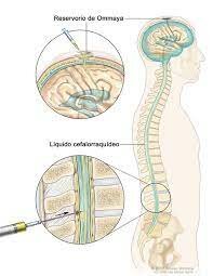 Tejidos a nivel intratecal