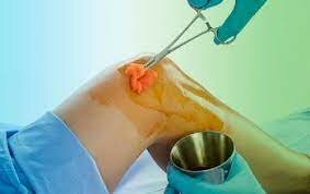 LA ASEPSIA Y ANTISEPSIA.