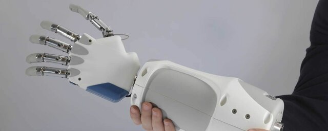 Mano biónica