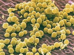 Levadura como Organismo vivo