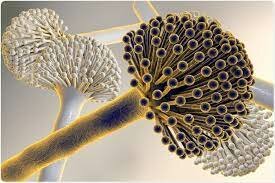 Infecciones por Aspergillus sp