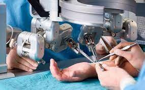 CIRUGIA ROBOTICA: