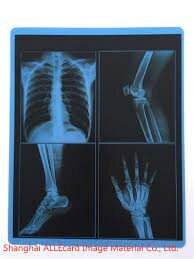 Carteles de Rayos X – 1932