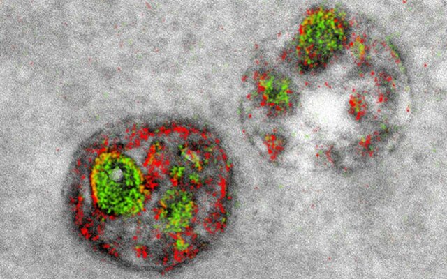 Mirada a las estructuras subcelulares y organelas de una célula