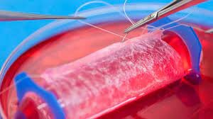 Producción de cartílago mediante ingeniería de tejidos.