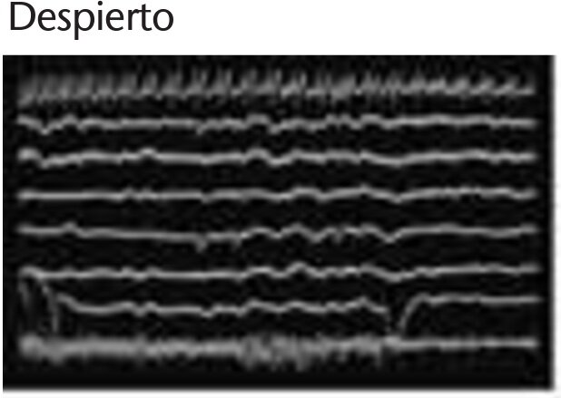 Fase crepuscular inicial