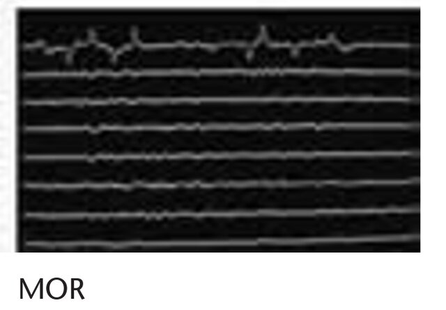 MOR