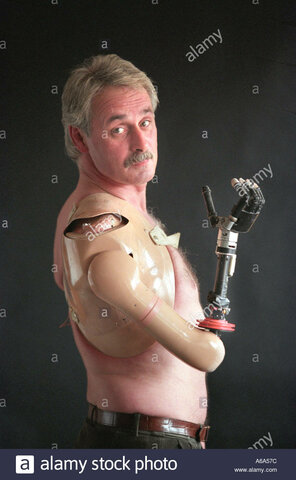 Brazo modular Edinburg (EMAS)