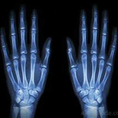 Timeline: Radiación electromagnética en la medicina