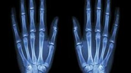 Timeline: Radiación electromagnética en la medicina