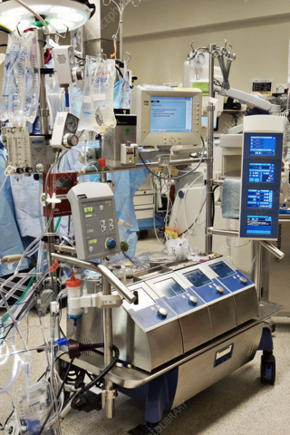 Maquina corazón-pulmón artificial