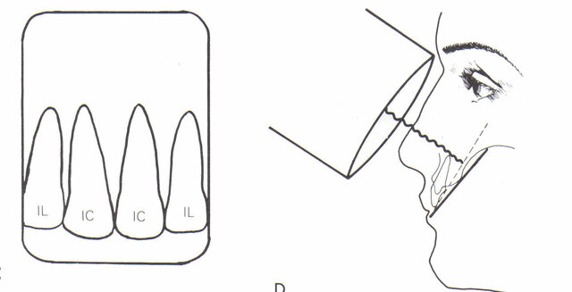 se redefine la técnica