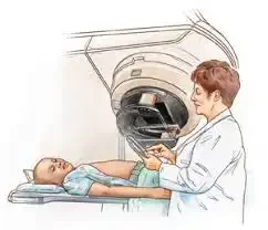 Terapia para el cancer con radiacion