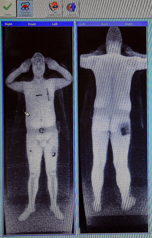 Invencion de equipos de rayos X