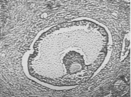 Óvulo y folículo de Graaf