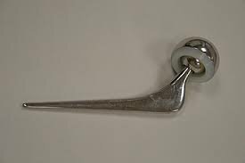 First Metal Hip Replacement