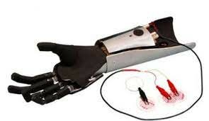 Aparece la primera Prótesis Mioeléctrica