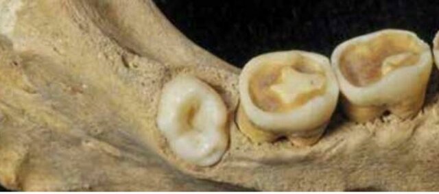 CURACIONES CON CERA DE ABEJA