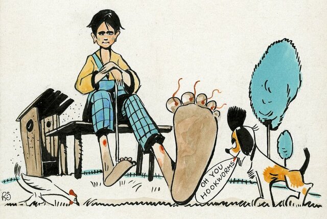 the scourge of the south - hookworm