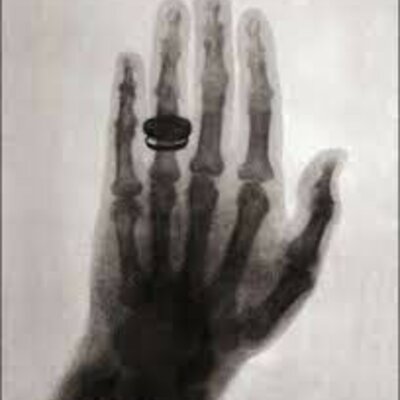 Timeline: Descubrimiento de los Rayos X