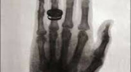 Timeline: Descubrimiento de los Rayos X