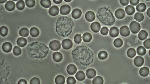 Microscopía de contraste