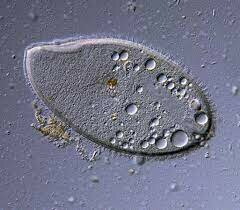 Microscopia de contraste de interferencia diferencial