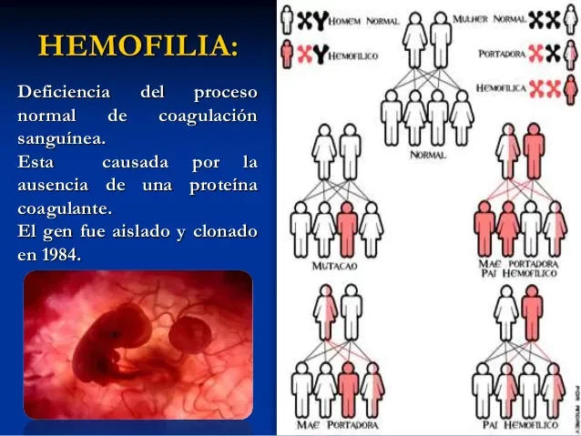 El gen DE LA HEMOFILIA  aislado