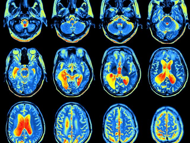 Consciousness Explained