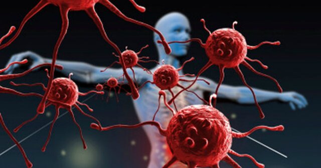 Secuenciación del exoma/Genes de enfermedades raras: