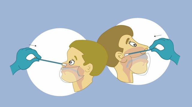 Reacción en cadena de la polimerasa (PCR)