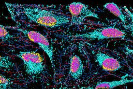 Primer cultivo de células humanas