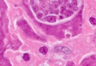 Descubrimiento científico de impacto