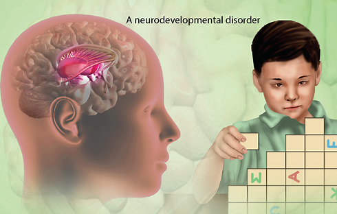 Classification of Autism