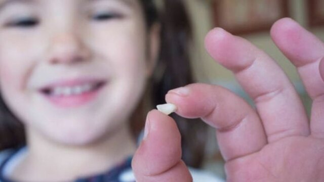 Caida de mi primer diente