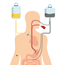 Se crean sondas para alimentación enteral, gastrostomías y yeyunostomías.